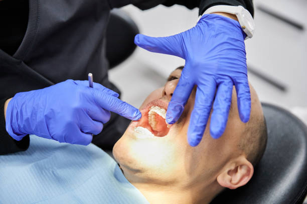 Best Broken or Cracked Tooth Emergency Dentist in Windsor, MO